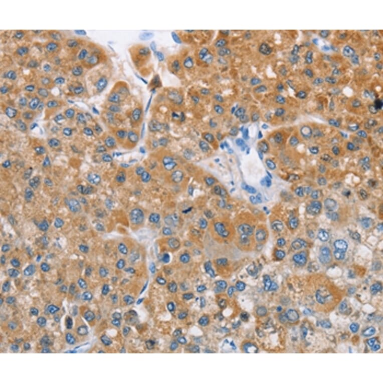 Immunohistochemistry - BDH1 Antibody from Signalway Antibody (36279) - Antibodies.com