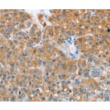 Immunohistochemistry - BDH1 Antibody from Signalway Antibody (36279) - Antibodies.com