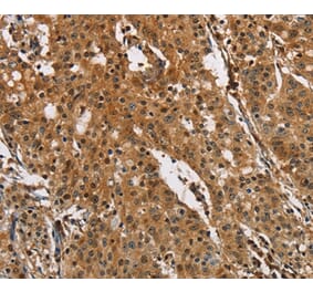 Immunohistochemistry - PTK6 Antibody from Signalway Antibody (36291) - Antibodies.com