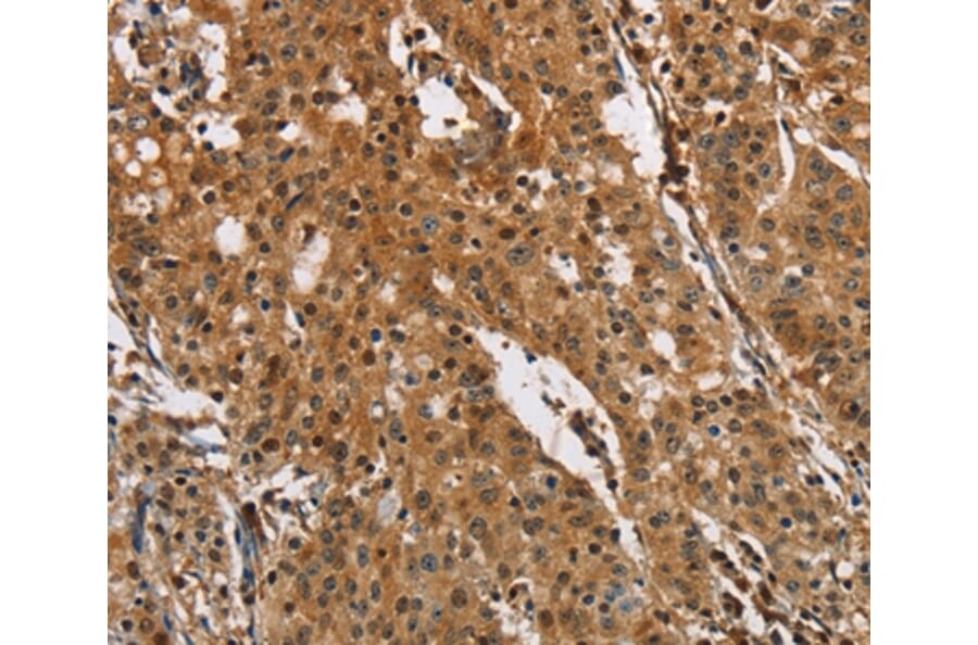 Immunohistochemistry - PTK6 Antibody from Signalway Antibody (36291) - Antibodies.com