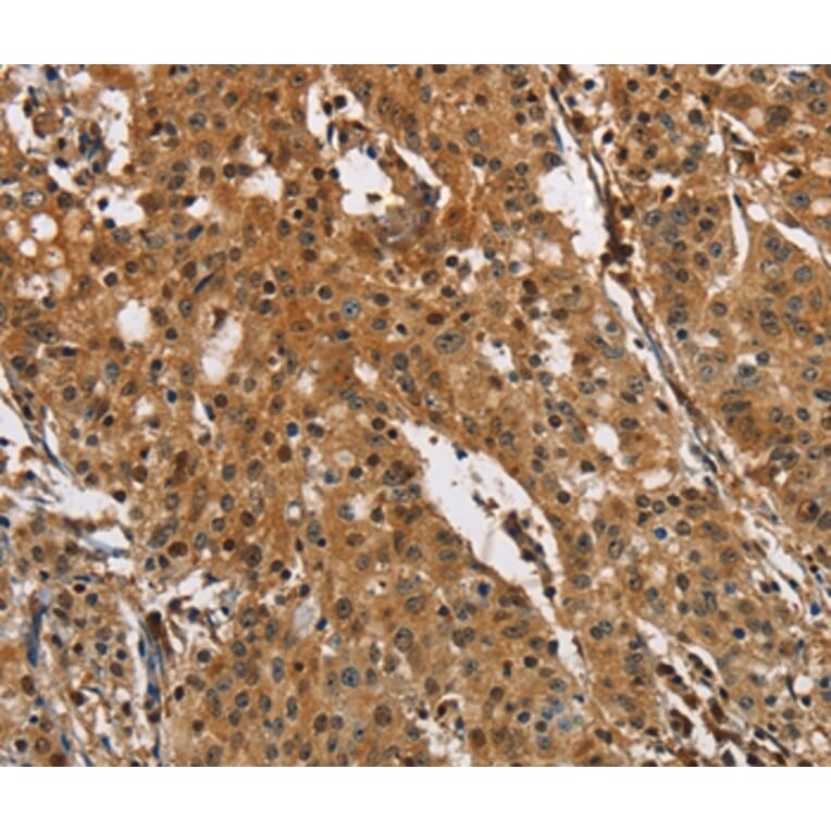 Immunohistochemistry - PTK6 Antibody from Signalway Antibody (36291) - Antibodies.com