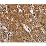 Immunohistochemistry - PTK6 Antibody from Signalway Antibody (36291) - Antibodies.com
