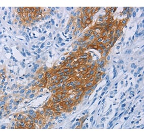 Immunohistochemistry - CCR9 Antibody from Signalway Antibody (36317) - Antibodies.com