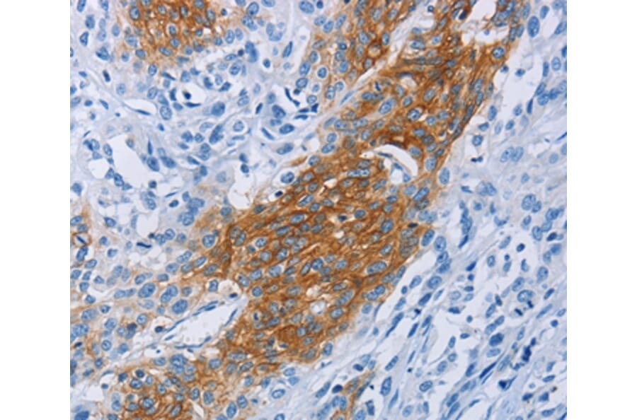 Immunohistochemistry - CCR9 Antibody from Signalway Antibody (36317) - Antibodies.com
