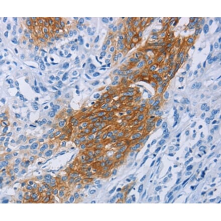 Immunohistochemistry - CCR9 Antibody from Signalway Antibody (36317) - Antibodies.com