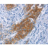 Immunohistochemistry - CCR9 Antibody from Signalway Antibody (36317) - Antibodies.com