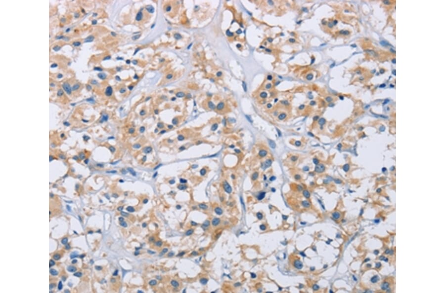 Immunohistochemistry - CCR9 Antibody from Signalway Antibody (36317) - Antibodies.com