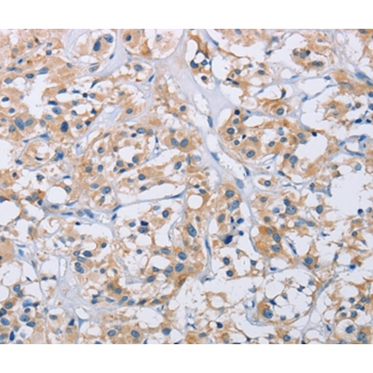 Immunohistochemistry - CCR9 Antibody from Signalway Antibody (36317) - Antibodies.com