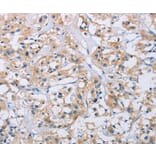 Immunohistochemistry - CCR9 Antibody from Signalway Antibody (36317) - Antibodies.com