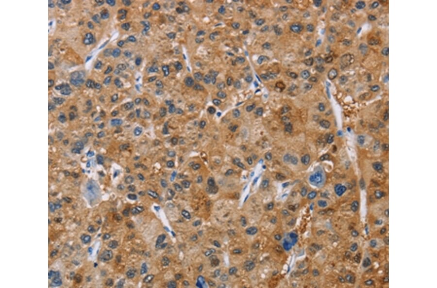 Immunohistochemistry - NCR3 Antibody from Signalway Antibody (36330) - Antibodies.com
