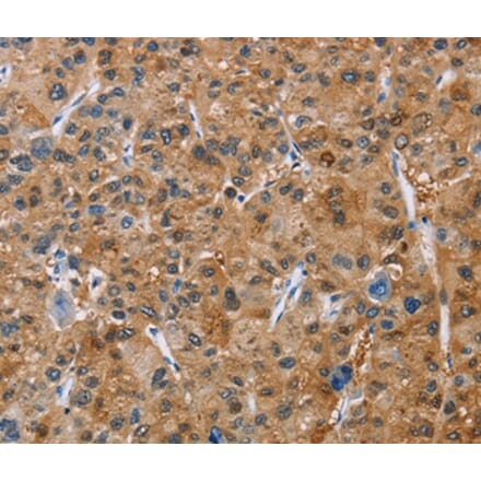 Immunohistochemistry - NCR3 Antibody from Signalway Antibody (36330) - Antibodies.com
