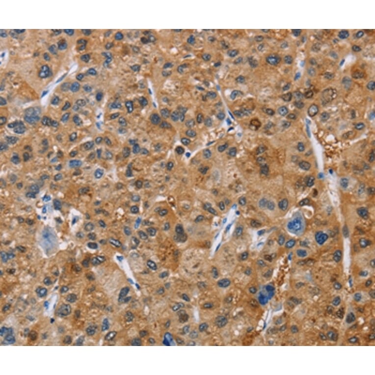 Immunohistochemistry - NCR3 Antibody from Signalway Antibody (36330) - Antibodies.com