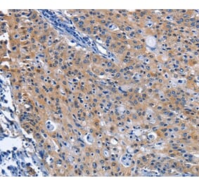Immunohistochemistry - CDO1 Antibody from Signalway Antibody (36337) - Antibodies.com
