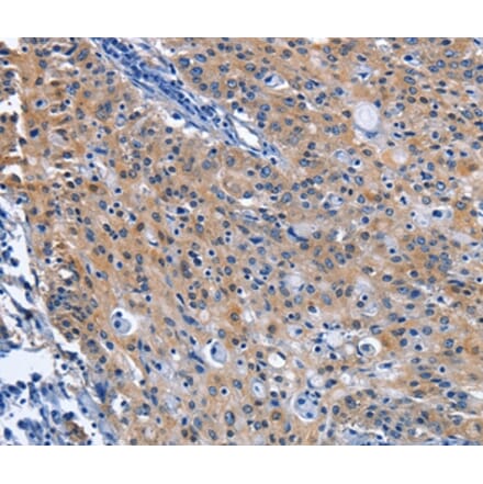 Immunohistochemistry - CDO1 Antibody from Signalway Antibody (36337) - Antibodies.com