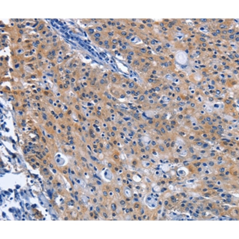 Immunohistochemistry - CDO1 Antibody from Signalway Antibody (36337) - Antibodies.com