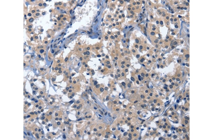 Immunohistochemistry - CDO1 Antibody from Signalway Antibody (36337) - Antibodies.com