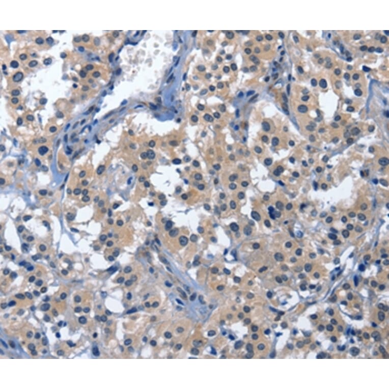 Immunohistochemistry - CDO1 Antibody from Signalway Antibody (36337) - Antibodies.com