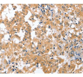 Immunohistochemistry - CDR2 Antibody from Signalway Antibody (36338) - Antibodies.com