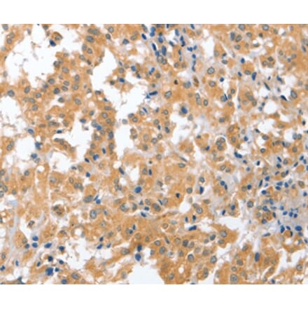 Immunohistochemistry - CDR2 Antibody from Signalway Antibody (36338) - Antibodies.com