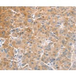 Immunohistochemistry - CDR2 Antibody from Signalway Antibody (36338) - Antibodies.com