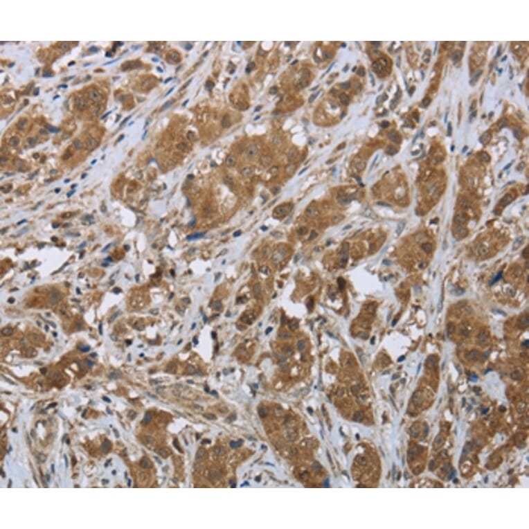 Immunohistochemistry - CLPS Antibody from Signalway Antibody (36357) - Antibodies.com