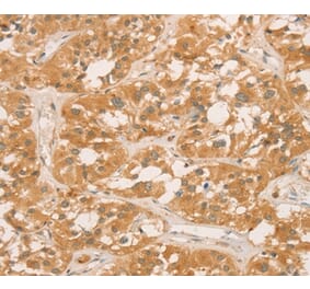 Immunohistochemistry - CPB1 Antibody from Signalway Antibody (36365) - Antibodies.com