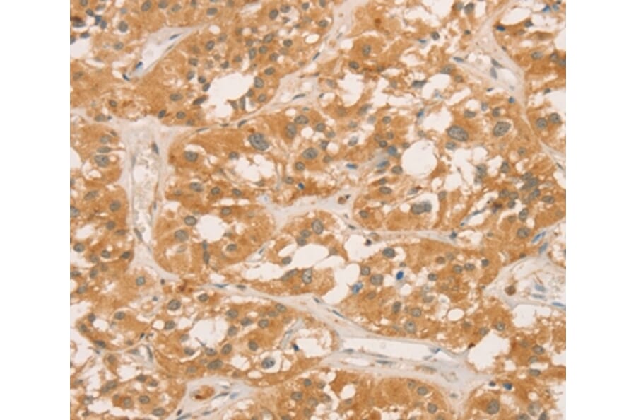 Immunohistochemistry - CPB1 Antibody from Signalway Antibody (36365) - Antibodies.com