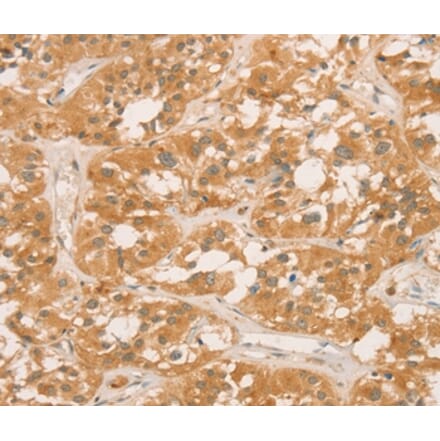 Immunohistochemistry - CPB1 Antibody from Signalway Antibody (36365) - Antibodies.com