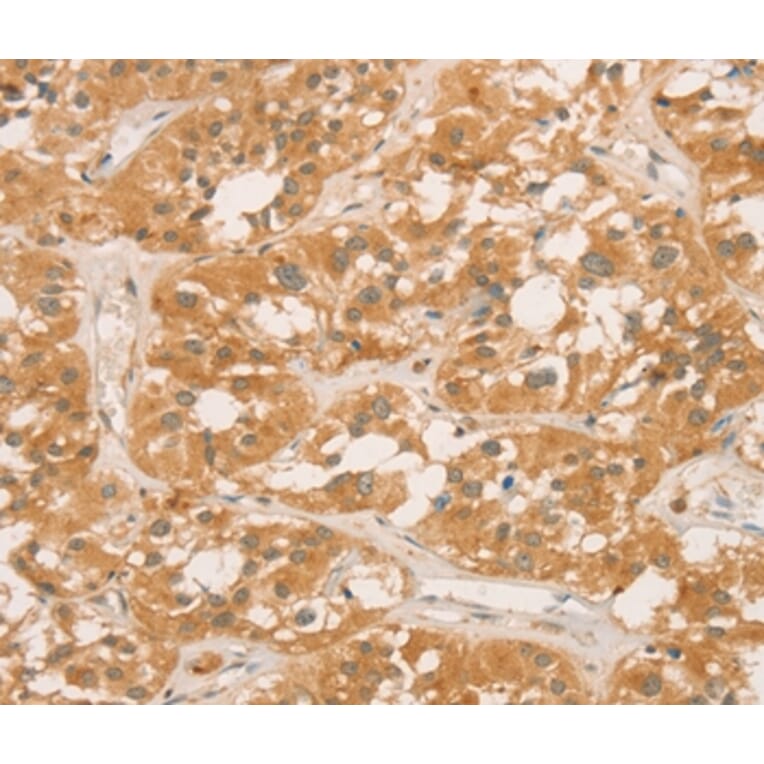 Immunohistochemistry - CPB1 Antibody from Signalway Antibody (36365) - Antibodies.com