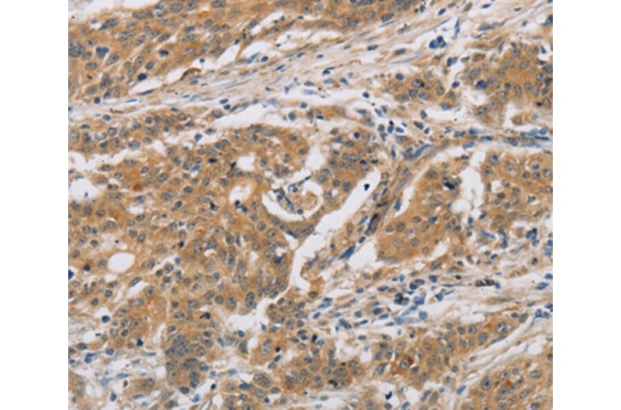 Immunohistochemistry - CST6 Antibody from Signalway Antibody (36393) - Antibodies.com