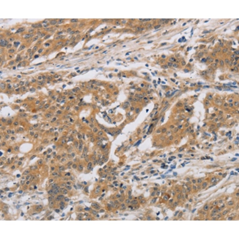 Immunohistochemistry - CST6 Antibody from Signalway Antibody (36393) - Antibodies.com