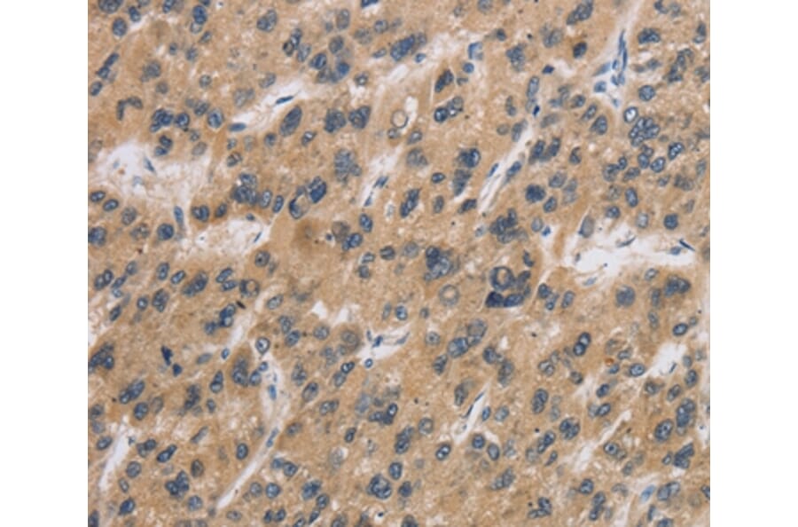 Immunohistochemistry - CST6 Antibody from Signalway Antibody (36393) - Antibodies.com