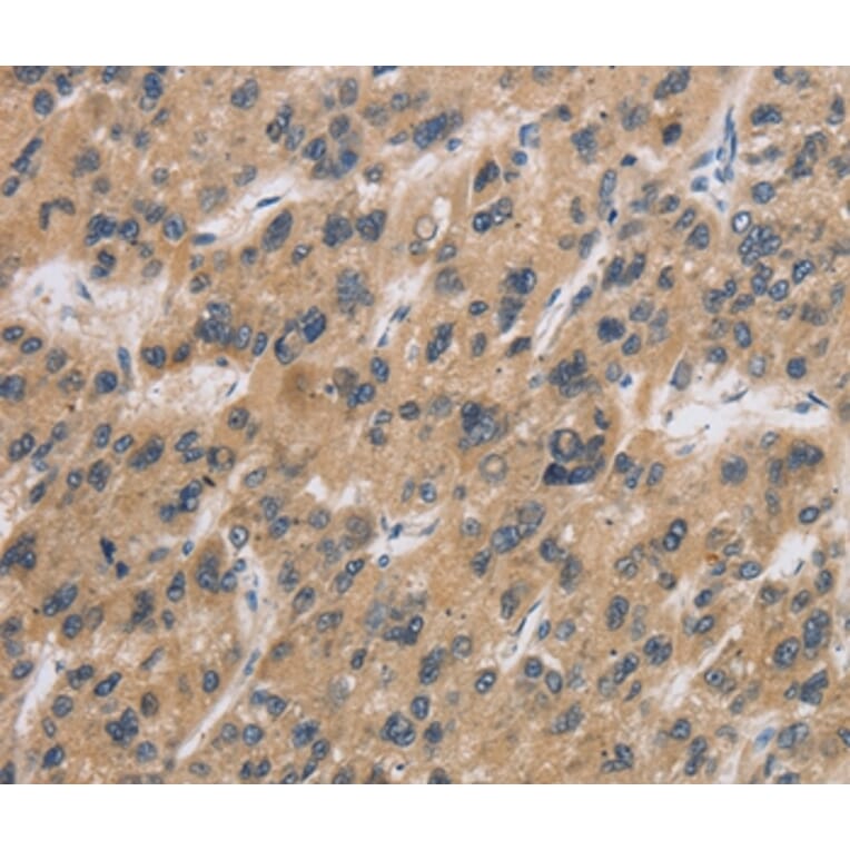 Immunohistochemistry - CST6 Antibody from Signalway Antibody (36393) - Antibodies.com