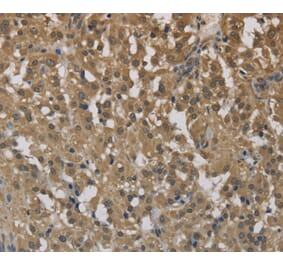 Immunohistochemistry - CYBA Antibody from Signalway Antibody (36394) - Antibodies.com