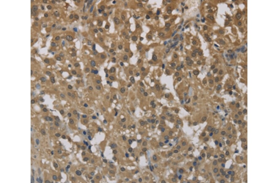 Immunohistochemistry - CYBA Antibody from Signalway Antibody (36394) - Antibodies.com