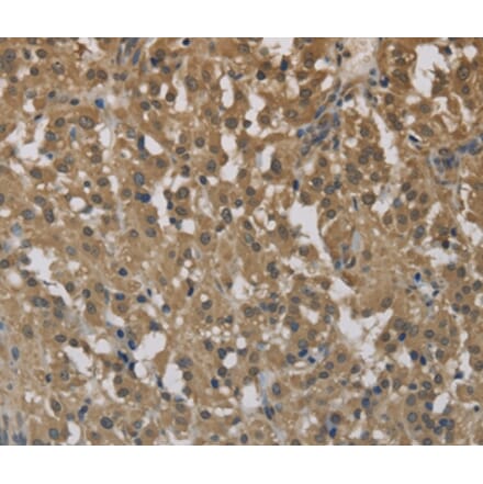 Immunohistochemistry - CYBA Antibody from Signalway Antibody (36394) - Antibodies.com