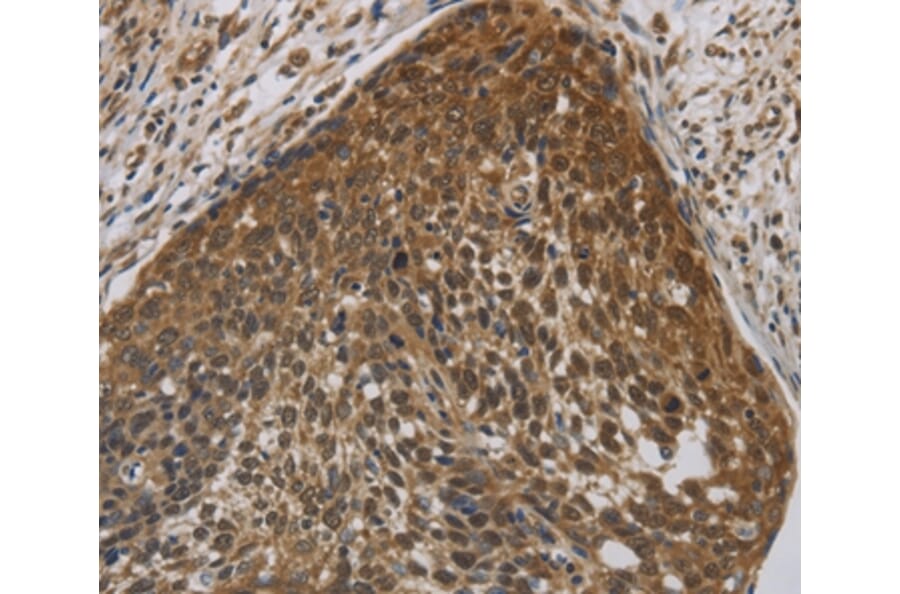 Immunohistochemistry - CYBA Antibody from Signalway Antibody (36394) - Antibodies.com