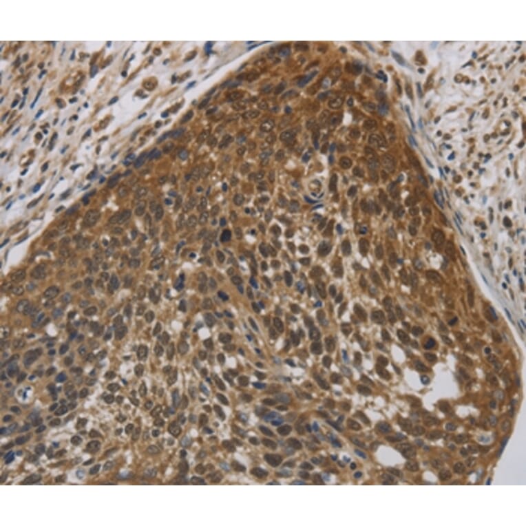 Immunohistochemistry - CYBA Antibody from Signalway Antibody (36394) - Antibodies.com