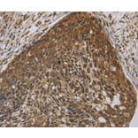Immunohistochemistry - CYBA Antibody from Signalway Antibody (36394) - Antibodies.com