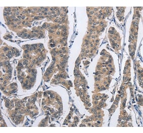 Immunohistochemistry - DSG2 Antibody from Signalway Antibody (36413) - Antibodies.com