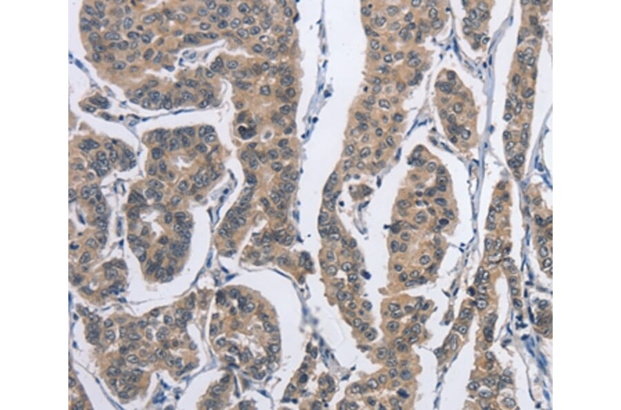Immunohistochemistry - DSG2 Antibody from Signalway Antibody (36413) - Antibodies.com