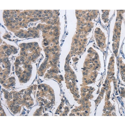 Immunohistochemistry - DSG2 Antibody from Signalway Antibody (36413) - Antibodies.com