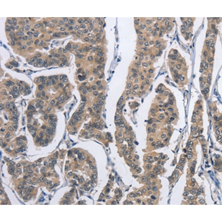 Immunohistochemistry - DSG2 Antibody from Signalway Antibody (36413) - Antibodies.com