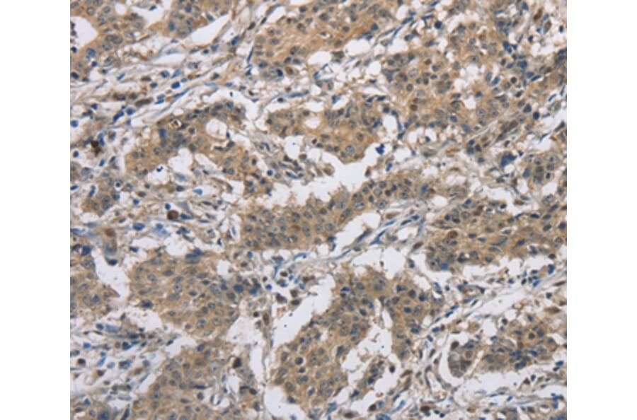 Immunohistochemistry - DSG2 Antibody from Signalway Antibody (36413) - Antibodies.com