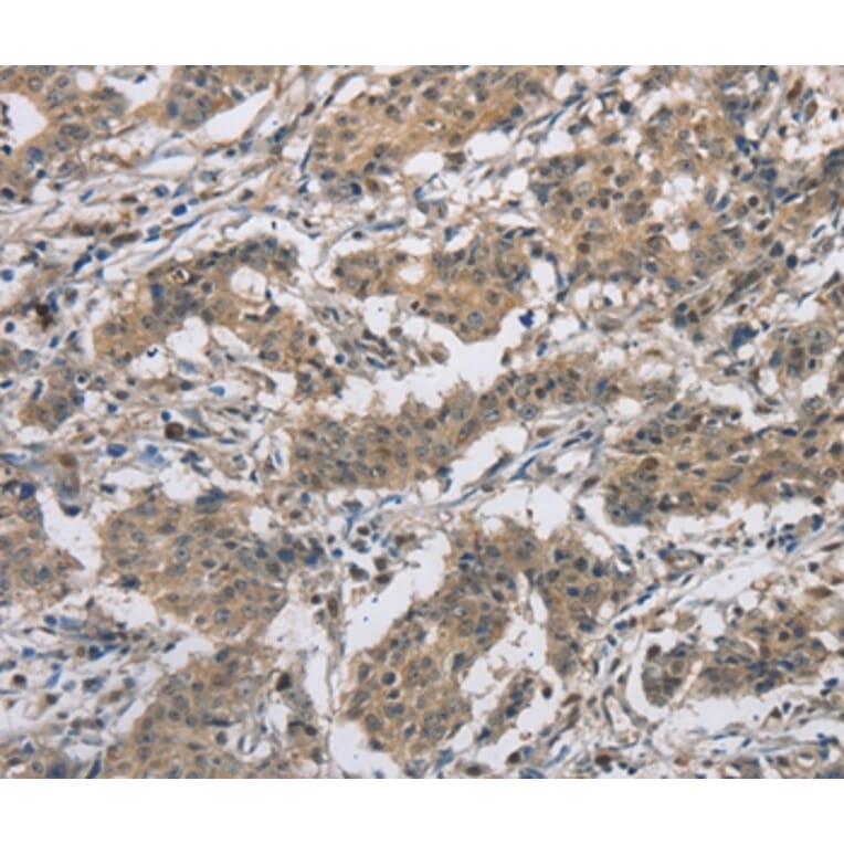 Immunohistochemistry - DSG2 Antibody from Signalway Antibody (36413) - Antibodies.com