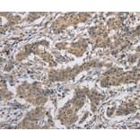 Immunohistochemistry - DSG2 Antibody from Signalway Antibody (36413) - Antibodies.com