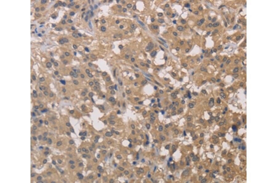 Immunohistochemistry - DSTN Antibody from Signalway Antibody (36414) - Antibodies.com