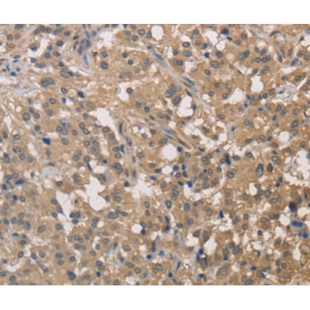 Immunohistochemistry - DSTN Antibody from Signalway Antibody (36414) - Antibodies.com