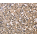 Immunohistochemistry - DSTN Antibody from Signalway Antibody (36414) - Antibodies.com