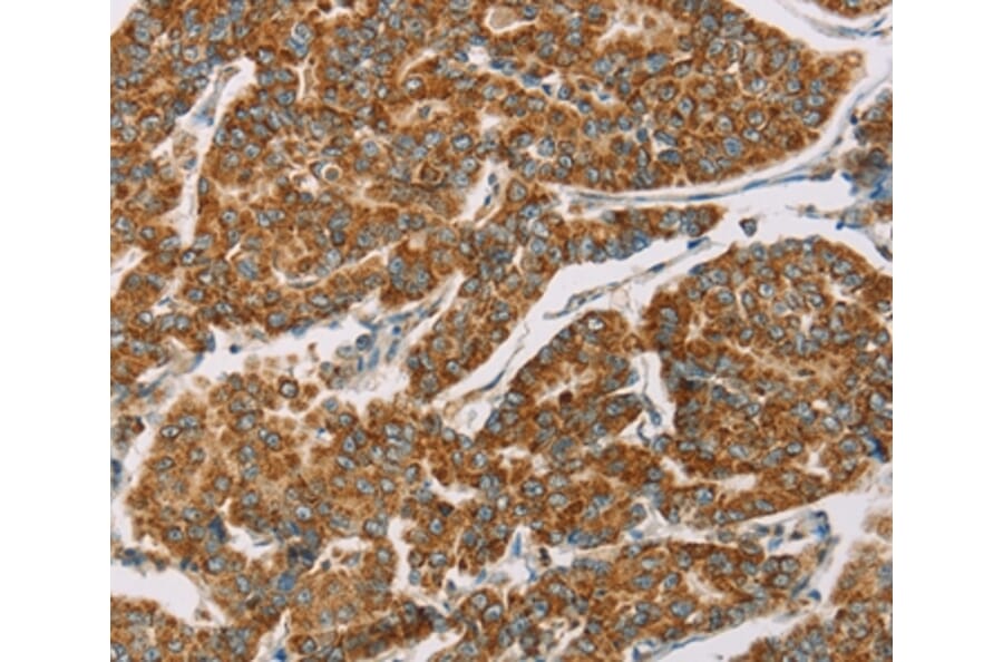 Immunohistochemistry - DLL4 Antibody from Signalway Antibody (36418) - Antibodies.com